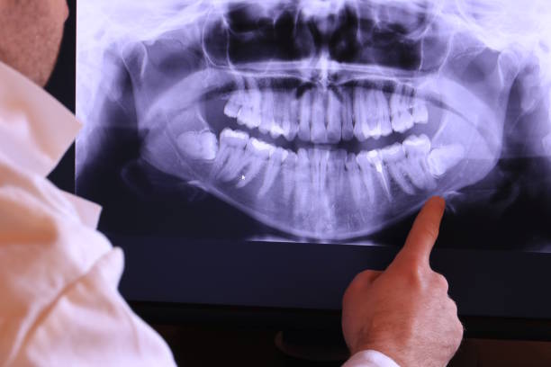 Best Emergency Dental Services for Seniors in Gooding, ID