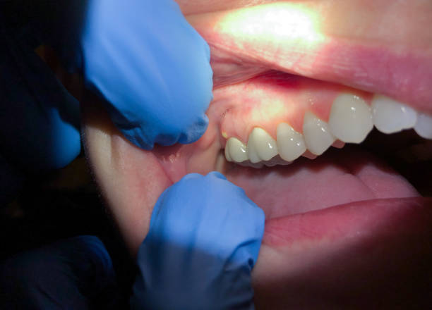 Best Broken or Cracked Tooth Emergency Dentist in Gooding, ID